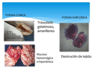 FORMA CLÍNICA
FORMA SUBCLÍNICA
Trasudado
gelatinoso,
amarillento
Mucosa
hemorrágica
o hiperémica
Destrución de tejido
 