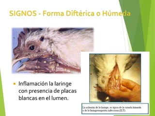  Inflamación la laringe
con presencia de placas
blancas en el lumen.
 