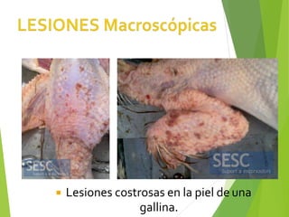  Lesiones costrosas en la piel de una
gallina.
 