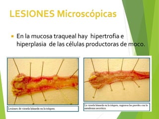  En la mucosa traqueal hay hipertrofia e
hiperplasia de las células productoras de moco.
 