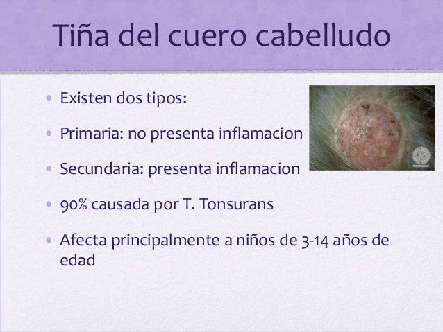 Como sanar que han arraigado la uña