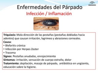 Enfermedades del Párpado
Infección / Inflamación
Triquiasis: Mala dirección de las pestañas (pestañas dobladas hacia
adent...