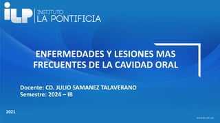 <#>
www.ilp.edu.pe
2021
ENFERMEDADES Y LESIONES MAS
FRECUENTES DE LA CAVIDAD ORAL
Docente: CD. JULIO SAMANEZ TALAVERANO
Semestre: 2024 – IB
 