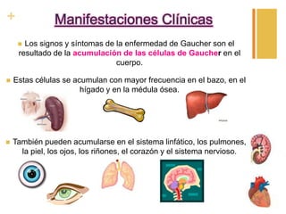 +

Manifestaciones Clínicas
Los signos y síntomas de la enfermedad de Gaucher son el
resultado de la acumulación de las células de Gaucher en el
cuerpo.





Estas células se acumulan con mayor frecuencia en el bazo, en el
hígado y en la médula ósea.



También pueden acumularse en el sistema linfático, los pulmones,
la piel, los ojos, los riñones, el corazón y el sistema nervioso.

 