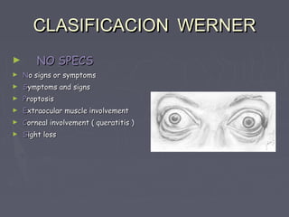 CLASIFICACION WERNER
►       NO SPECS
►   No signs or symptoms
►   Symptoms and signs
►   Proptosis
►   Extraocular muscle involvement
►   Corneal involvement ( queratitis )
►   Sight loss
 
