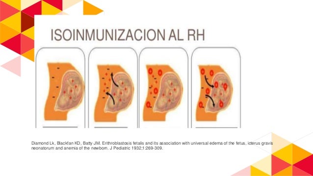 Enfermedad Hemolítica del Recién Nacido