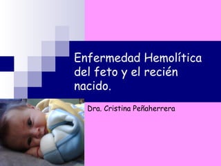 Enfermedad Hemolítica
del feto y el recién
nacido.
Dra. Cristina Peñaherrera
 