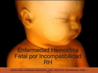 Enfermedad Hemolítica
Fetal por Incompatibilidad
RH
MARÍA CAMILA ARANGO GRANADOS; CÓD. 08201079; UNIVERSIDAD ICESI –
FVL

 