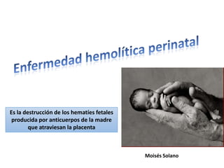 Es la destrucción de los hematíes fetales
producida por anticuerpos de la madre
que atraviesan la placenta
Moisés Solano
 