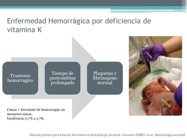 Enfermedad hemorragica del recien nacido