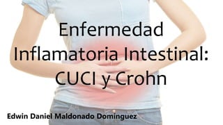 |
Enfermedad
Inflamatoria Intestinal:
CUCI y Crohn
Edwin Daniel Maldonado Domínguez
 