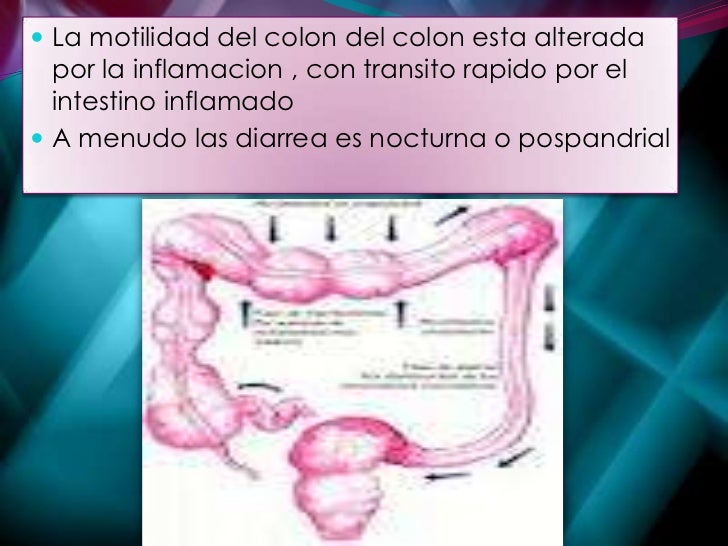 Enfermedad Inflamatoria Intestinal By Juce