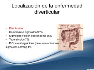 Localización de la enfermedad
diverticular
• Distribución:
• Compromiso sigmoideo 95%
• Sigmoides y colon descendente 65%
• Todo el colon 7%
• Próximo al sigmoides (pero manteniendo el
sigmoides normal) 4%
 