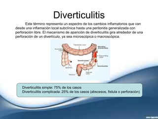 Diverticulitis
Este término representa un espectro de los cambios inflamatorios que van
desde una inflamación local subclínica hasta una peritonitis generalizada con
perforación libre. El mecanismo de aparición de diverticulitis gira alrededor de una
perforación de un divertículo, ya sea microscópica o macroscópica.
Diverticulitis simple: 75% de los casos
Diverticulitis complicada: 25% de los casos (abscesos, fistula o perforación)
 