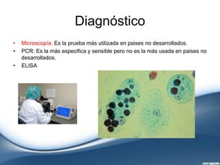 Diagnóstico
• Microscopía: Es la prueba más utilizada en paises no desarrollados.
• PCR: Es la más especifica y sensible pero no es la más usada en paises no
desarrollados.
• ELISA
 