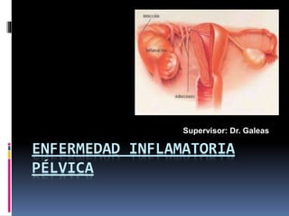 ENFERMEDAD INFLAMATORIA
PÉLVICA
Supervisor: Dr. Galeas
 