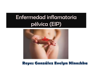 Enfermedad inflamatoria
      pélvica (EIP)




  Reyes González Evelyn Ninoshka
 