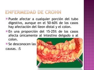Puede afectar a cualquier porción del tubo digestivo, aunque en el 50-60% de los casos hay afectación del íleon distal y el colon. En una proporción del 15-25% de los casos afecta únicamente al intestino delgado o al colon. Se desconocen las  causas. :S 
