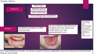 Cuadro Clínico
Podromo
Fiebre ligera
Malestar general
Dolor abdominal
Sintomatología tipo respiratorio
Las lesiones iniciales en el 90%
(mucosa oral)
SIGNOS
Pared delgada
Coloración gris
perla
Halo eritematoso
No son circulares
No se observa
vesículas en tejido
gingival ni en
labios (NO en
sitios
queratinizados)
Se van a observar vesículas que al
romperse van a ser ulceras que
miden entre 3 y 7 mm
(generalmente 5 mm)
Dra. Virginia Martínez Estrada,* Dr. Moisés Laureano Lazcano; medigraphic Artemisa en lÌnea; Rev Cent Dermatol
Pascua • Vol. 8, Núm
 