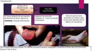 24 horas después de que aparece
las lesiones en boca aparece el
exantema (macula eritematosa)
Clasificación
Lengua 44 %
Mucosa bucal
Úvula
Pilares amigdalinos
Sitios NO
Quertinizados
aparecen las vesículas
cutáneas (3 -7 mm) con borde
eritematoso
Sitios en que se vana
encontrar en manos y pies
En las caras laterales de los
dedos y en las palmas
Dra. Virginia Martínez Estrada,* Dr. Moisés Laureano Lazcano; medigraphic Artemisa en lÌnea; Rev Cent Dermatol
Pascua • Vol. 8, Núm
 