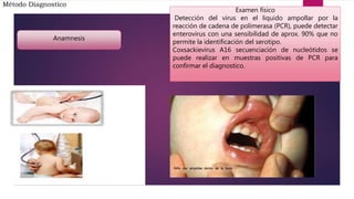 Método Diagnostico
Anamnesis
Examen físico
Detección del virus en el liquido ampollar por la
reacción de cadena de polimerasa (PCR), puede detectar
enterovirus con una sensibilidad de aprox. 90% que no
permite la identificación del serotipo.
Coxsackievirus A16 secuenciación de nucleótidos se
puede realizar en muestras positivas de PCR para
confirmar el diagnostico.
 