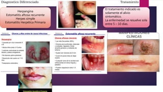 Diagnostico Diferenciado
Herpangina
Estomatitis aftosa recurrente
Herpes simple
Estomatitis Herpética Primaria
Tratamiento
El tratamiento indicado es
solamente el alivio
sintomático.
La enfermedad se resuelve sola
entre 5 – 10 días.
 