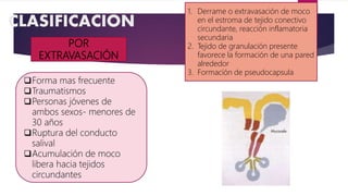 CLASIFICACION
POR
EXTRAVASACIÓN
Forma mas frecuente
Traumatismos
Personas jóvenes de
ambos sexos- menores de
30 años
Ruptura del conducto
salival
Acumulación de moco
libera hacia tejidos
circundantes
1. Derrame o extravasación de moco
en el estroma de tejido conectivo
circundante, reacción inflamatoria
secundaria
2. Tejido de granulación presente
favorece la formación de una pared
alrededor
3. Formación de pseudocapsula
 
