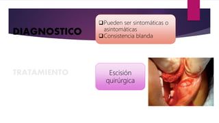 TRATAMIENTO
DIAGNOSTICO
Pueden ser sintomáticas o
asintomáticas
Consistencia blanda
Escisión
quirúrgica
 