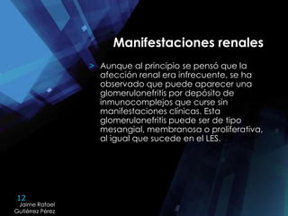 12
Jaime Rafael
Gutiérrez Pérez
Jaime Rafael
Gutiérrez Pérez
Manifestaciones renales
> Aunque al principio se pensó que la
afección renal era infrecuente, se ha
observado que puede aparecer una
glomerulonefritis por depósito de
inmunocomplejos que curse sin
manifestaciones clínicas. Esta
glomerulonefritis puede ser de tipo
mesangial, membranosa o proliferativa,
al igual que sucede en el LES.
 