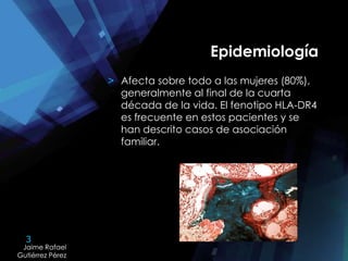 3
Jaime Rafael
Gutiérrez Pérez
Jaime Rafael
Gutiérrez Pérez
Epidemiología
> Afecta sobre todo a las mujeres (80%),
generalmente al final de la cuarta
década de la vida. El fenotipo HLA-DR4
es frecuente en estos pacientes y se
han descrito casos de asociación
familiar.
 