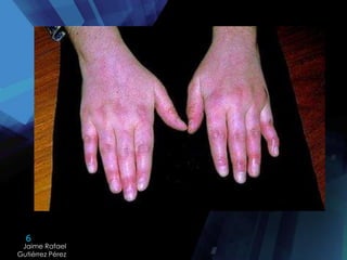 6
Jaime Rafael
Gutiérrez Pérez
 