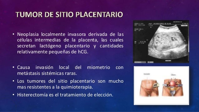 Tumor placentario pdf