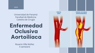 Enfermedad
Oclusiva
Aortoilíaca
Rosario Villa Núñez
X semestre
2023
Universidad de Panamá
Facultad de Medicina
Catedra de Cirugía
 