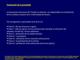 Evaluación de la gravedad
La Asociación Americana del Tiroides ha descrito con objetividad una clasificación
de los cambios oculares de la Enfermedad de Graves .
Por consiguiente, la gravedad varía de 0 a VI.
● Clase 0 - No hay síntomas o signos
● Clase I - Sólo los signos, no hay síntomas (por ejemplo, la retracción del
párpado, mirada fija, retraso palpebral)
● Clase II - afectación de los tejidos blandos
● Clase III - La proptosis
● Clase IV - afectación de los músculos extraoculares
● Clase V - la participación de la córnea
● Clase VI - pérdida de visión (afectación del nervio óptico)
Untreated Graves' disease patients without clinical ophthalmopathy demonstrate a high frequency of extraocular muscle (EOM) enlargement
by magnetic resonance. Villadolid MC, Yokoyama N, Izumi M, Nishikawa T, Kimura H, Ashizawa K, Kiriyama T, Uetani M, Nagataki S J Clin
Endocrinol Metab. 1995;80(9):2830.
 