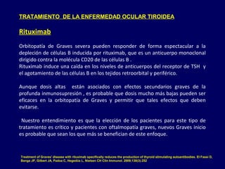 TRATAMIENTO DE LA ENFERMEDAD OCULAR TIROIDEA
Rituximab
Orbitopatía de Graves severa pueden responder de forma espectacular a la
depleción de células B inducida por rituximab, que es un anticuerpo monoclonal
dirigido contra la molécula CD20 de las células B .
Rituximab induce una caída en los niveles de anticuerpos del receptor de TSH y
el agotamiento de las células B en los tejidos retroorbital y periférico.
Aunque dosis altas están asociados con efectos secundarios graves de la
profunda inmunosupresión , es probable que dosis mucho más bajas pueden ser
eficaces en la orbitopatía de Graves y permitir que tales efectos que deben
evitarse.
Nuestro entendimiento es que la elección de los pacientes para este tipo de
tratamiento es crítico y pacientes con oftalmopatía graves, nuevos Graves inicio
es probable que sean los que más se benefician de este enfoque.
Treatment of Graves' disease with rituximab specifically reduces the production of thyroid stimulating autoantibodies. El Fassi D,
Banga JP, Gilbert JA, Padoa C, Hegedüs L, Nielsen CH Clin Immunol. 2009;130(3):252
 