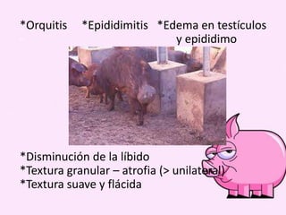 *Orquitis
-

*Epididimitis *Edema en testículos
y epididimo

*Disminución de la líbido
*Textura granular – atrofia (> unilateral)
*Textura suave y flácida

 