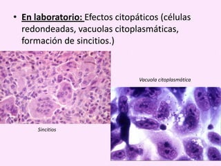 • En laboratorio: Efectos citopáticos (células
redondeadas, vacuolas citoplasmáticas,
formación de sincitios.)

Vacuola citoplasmática

Sincitios

 