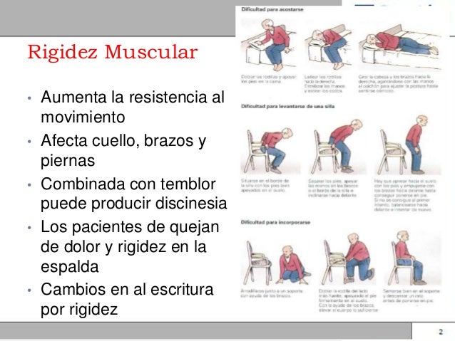 Rigidez muscular definicion