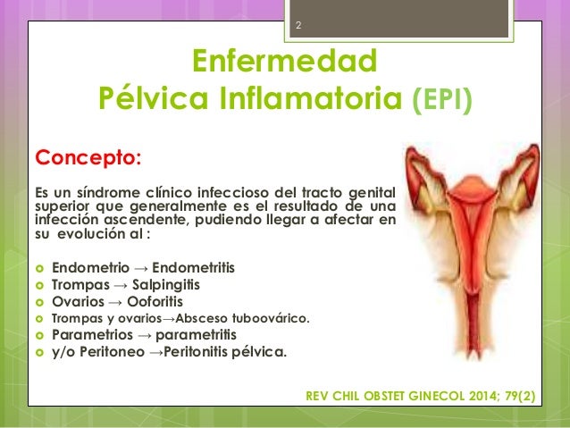 Enfermedad Pelvica Inflamatoria