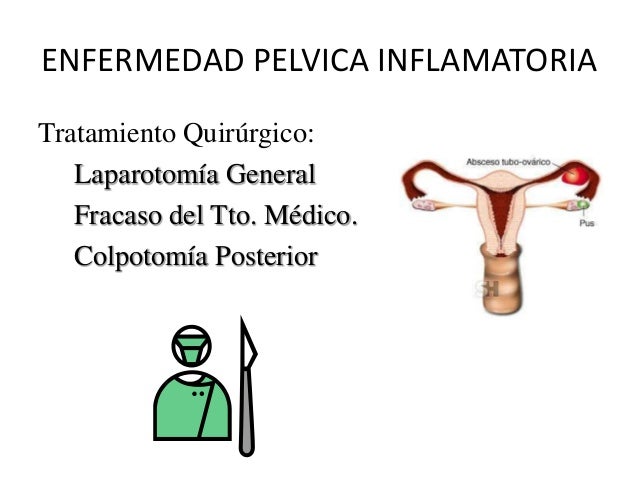 Enfermedad pelvica inflamatoria