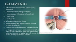 TRATAMIENTO
 El tratamiento es inicialmente conservador, y
consiste en:
 • Baños de asiento con agua templada.
 • Laxantes, que reblandezcan el bolo fecal.
 • Lubricantes.
 • Analgésicos.
En la fisura crónica se recomienda:
 Pomadas de nitratos tópicos (la más utilizada
trinitrato de glicerol).
 Otra opción conservadora es la toxina botulínica.
 La cirugía se reserva para los casos crónicos o tras
el fracaso de tratamiento médico. El tratamiento
quirúrgico consiste en realizar una esfinterotomía
interna lateral (EU) abierta o cerrada
 