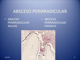 ABSCESO PERIRRADICULAR ABSCESO PERIRRADICULAR AGUDO ABSCESO PERIRRADICULAR CRONICO UNMSM Estomatologia Rehabilitadora II  www.endodonciaunmsm.blogspot.com 06/10/09 