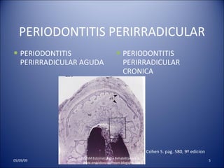 PERIODONTITIS PERIRRADICULAR PERIODONTITIS PERIRRADICULAR AGUDA PERIODONTITIS PERIRRADICULAR CRONICA UNMSM Estomatologia Rehabilitadora II  www.endodonciaunmsm.blogspot.com 06/10/09 Cohen S. pag. 580, 9º edicion 