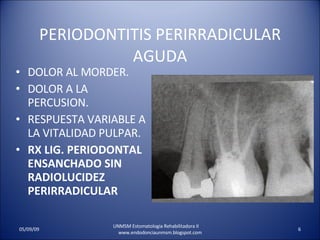 PERIODONTITIS PERIRRADICULAR AGUDA DOLOR AL MORDER. DOLOR A LA PERCUSION. RESPUESTA VARIABLE A LA VITALIDAD PULPAR. RX LIG. PERIODONTAL ENSANCHADO SIN RADIOLUCIDEZ PERIRRADICULAR UNMSM Estomatologia Rehabilitadora II  www.endodonciaunmsm.blogspot.com 06/10/09 