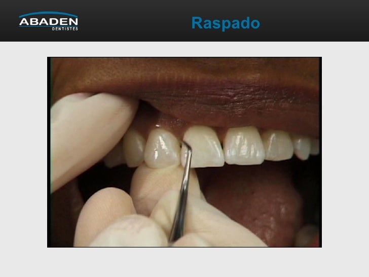 Enfermedad periodontal
