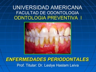 UNIVERSIDAD AMERICANA
FACULTAD DE ODONTOLOGIA

ODNTOLOGIA PREVENTIVA I

ENFERMEDADES PERIODONTALES
Prof. Titular: Dr. Leslye Haslam Leiva

 