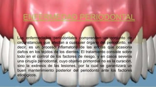 ENFERMEDAD PERIODONTAL
Las enfermedades periodontales comprenden un conjunto de
circunstancias que afectan a cualquier órgano del periodonto, es
decir, es un proceso inflamatorio de las encías que ocasiona
daños en los tejidos de los dientes. El tratamiento consiste sobre
todo en el control de los factores de riesgo, y en casos severos
una cirugía periodontal, cuyo objetivo primordial no es la curación,
sino la exéresis de las lesiones, por la cual se garantizará un
buen mantenimiento posterior del periodonto ante los factores
etiológicos.
 