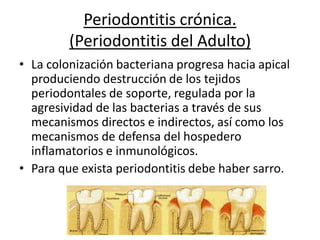 Periodontitis crónica.
(Periodontitis del Adulto)
• La colonización bacteriana progresa hacia apical
produciendo destrucción de los tejidos
periodontales de soporte, regulada por la
agresividad de las bacterias a través de sus
mecanismos directos e indirectos, así como los
mecanismos de defensa del hospedero
inflamatorios e inmunológicos.
• Para que exista periodontitis debe haber sarro.
 