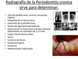 Radiografía de la Periodontitis cronica
sirve para determinar:
• Tipo de pérdida ósea, vertical, horizontal,
angular.
• Integridad de la lámina dura.
• Extensión de la pérdida ósea.
• Ancho del ligamento periodontal.
• Distancia de la cresta ósea al límite cemento
adamantino, se considera de 1 a 3 mm.
• Largo y forma de las raíces.
• Sarro ,
• Lesiones de furcas.
• Estado periapical.
• Fracturas.
• Reabsorciones radiculares
 