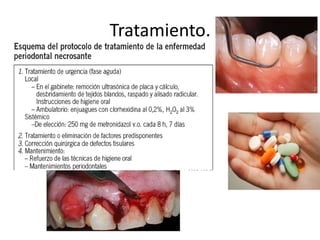 Tratamiento.
•
 